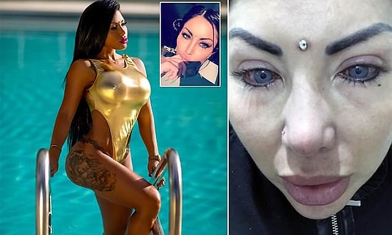 Gözlerinin Rengini Estetikle Değiştirmek İsterken Neredeyse Tamamen Kör Kalan Instagram Modeli
