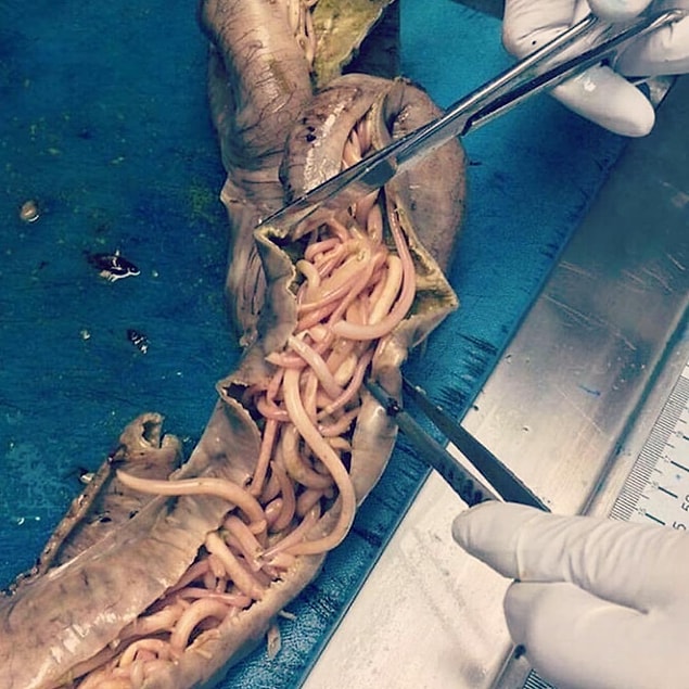 6. 35 cm'ye kadar ulaşabilen bağırsak solucanları, bir bağırsağı işgal etmiş!