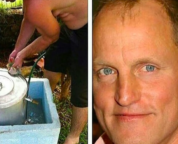 10. Живот этого мужчины выглядит как лицо Вуди Харрельсона 🙃