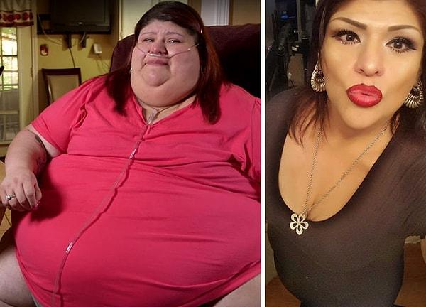 8. 73 kilo veren Laura Perez, 245 kiloyken şu an 172 kilo!