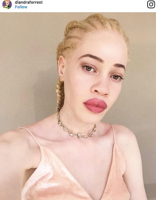 3. Диандра Форрест, США