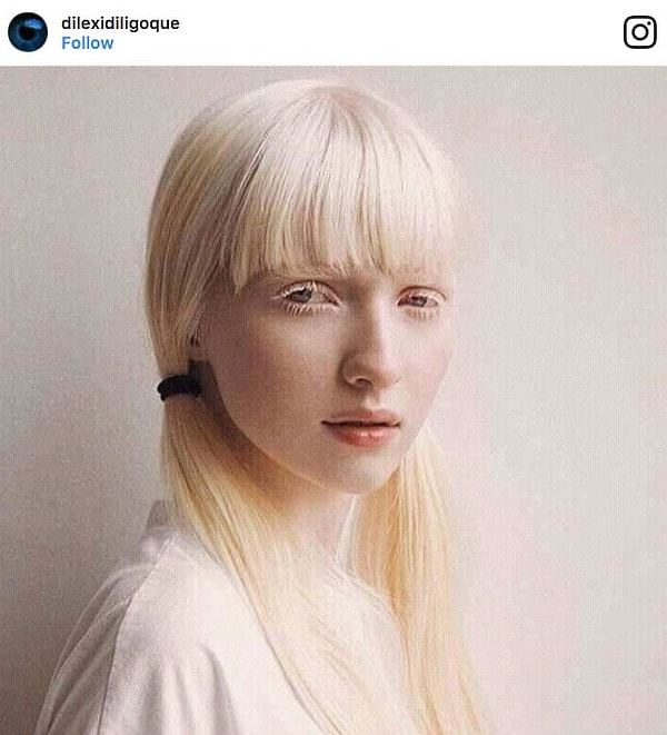 12. В Европе существует целое сообщество людей-альбиносов