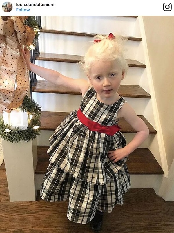 17. Луиз, США