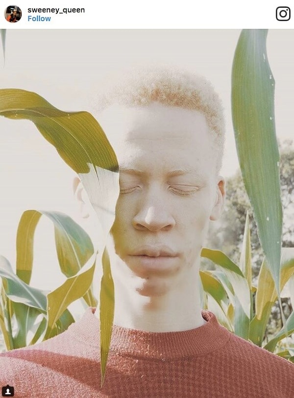 18. Парень-альбинос из Кении