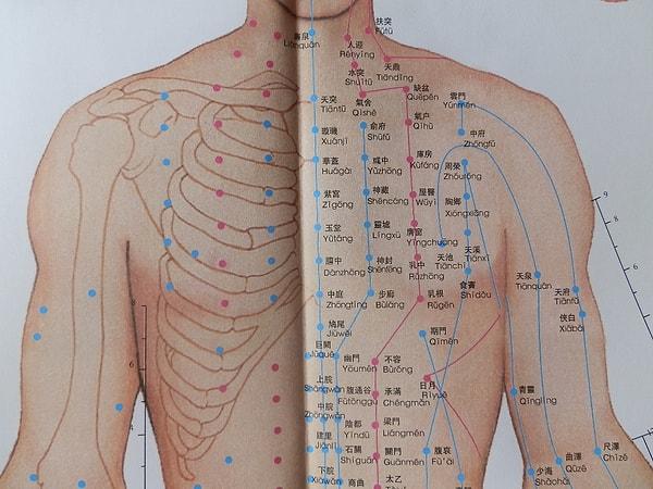 Akupunkturun Çin'den gelen 'geleneksel bir mucize' olmaması etkili olabileceği gerçeğini değiştirmeyebilir.