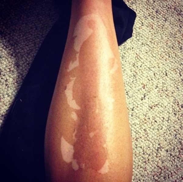 19. Как только ваша кожа начинает шелушиться, получается вот это: