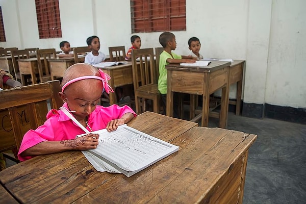 2. Она ходит в школу, как и любой другой ребенок