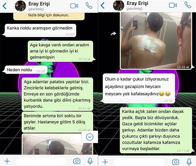 7. Dizilerin üzerimizdeki etkisi. :)