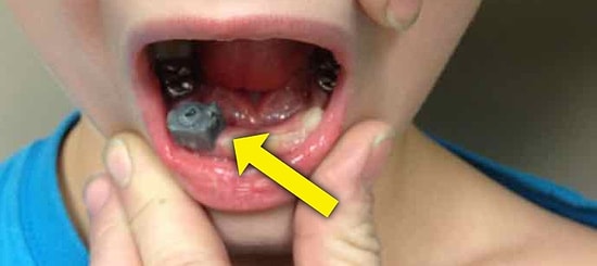 Her Gün Binlerce Hasta Fotoğrafı Teşhis Edilen, Doktorların Instagram'ı Figure 1'da Paylaşılan 14 İlginç Fotoğraf