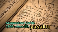 Sır Kapısını Aralıyoruz: Akupunktur Binlerce Yıllık Kadim Bir Bilim mi Yoksa Modern Bir Uydurmaca mı?