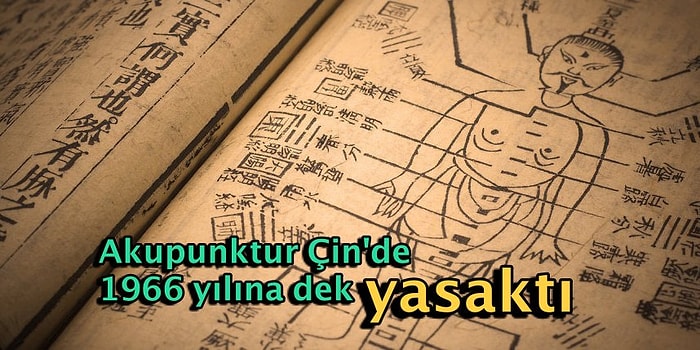 Sır Kapısını Aralıyoruz: Akupunktur Binlerce Yıllık Kadim Bir Bilim mi Yoksa Modern Bir Uydurmaca mı?