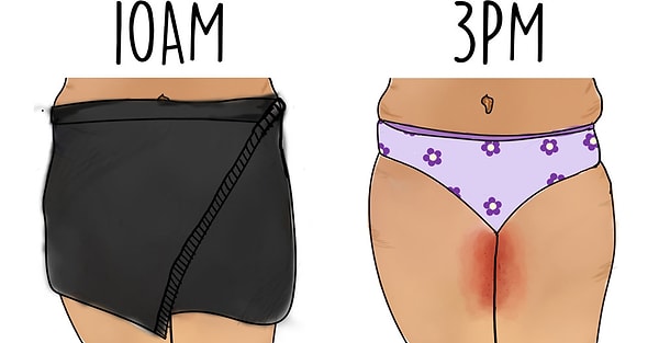 21. С одной стороны, вы любите свои бедра, но с другой стороны, вы ненавидите то, что их так жутко натирает, особенно в летний период