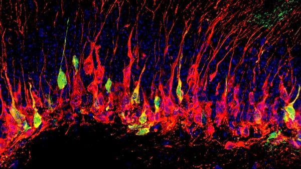 3. Beyinde yaklaşık 100 milyar hücre olduğu tahmin edilmektedir.