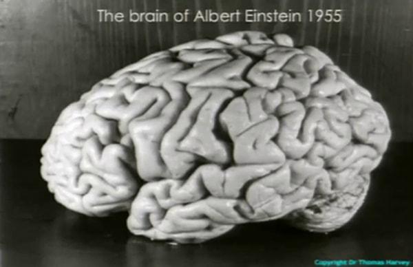 7. Einstein'in beynini müzede görebilirsiniz.