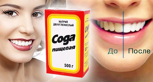 5. Сода поможет быстро отбелить зубы, если вы спешите.
