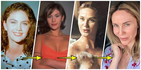 Çok Estetik Annecim! Botoks Bağımlısı Olan Demet Şener'in Geçmişten Günümüze Hepinizi Şok Edecek Evrimi