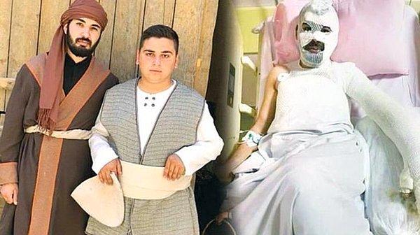 TRT için çekilen ve çekimleri Konya'da süren 'Bir Hadis Bir Film' dizisinin setinde oyuncu Muhammet Sinan Şenol ve sete koyun getiren çobanın 10 yaşındaki oğlu yanarak ağır yaralandı.