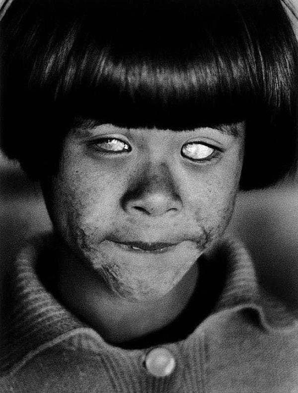 35. Hiroşima'ya atılan atom bombasından dolayı kör kalmış bir çocuk, 1945
