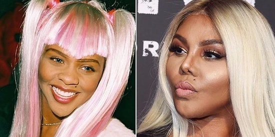 Остались с носом: Звезды, которым ринопластика пошла не на пользу