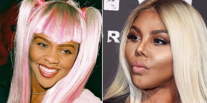 Остались с носом: Звезды, которым ринопластика пошла не на пользу