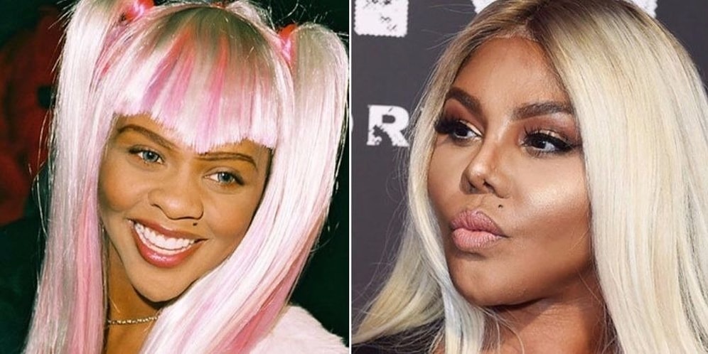 Остались с носом: Звезды, которым ринопластика пошла не на пользу