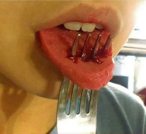 3. Не спешите звонить в скорую - это всего лишь сосиска и немного кетчупа 😄