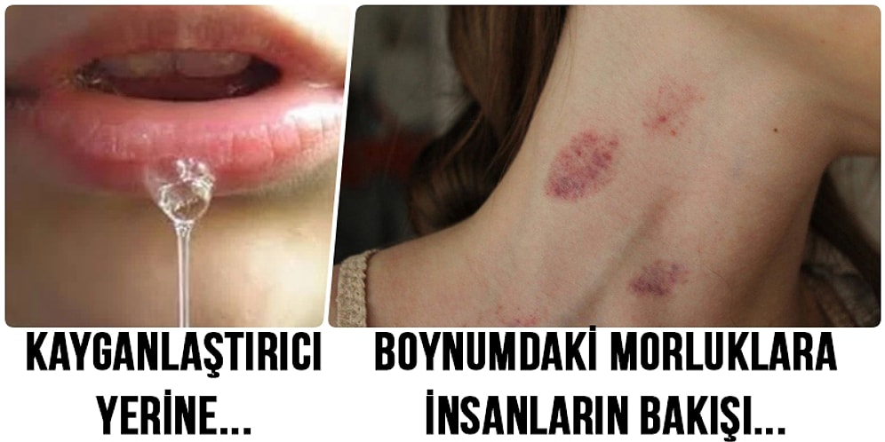 Seks Sırasında Yaşamaktan Keyif Alamadığı Şeyleri Bütün Çıplaklığıyla Paylaşan 18 Kişi
