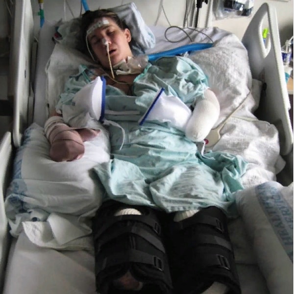 2. Через две недели у Кэрол поднялась температура под сорок и начались схватки. После экстренного кесарева сечения врачи обнаружили, что у Декер (предположительно из-за стрептококковой инфекции) развился сепсис.