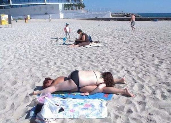 5. Когда солнцезащитного крема не хватило...