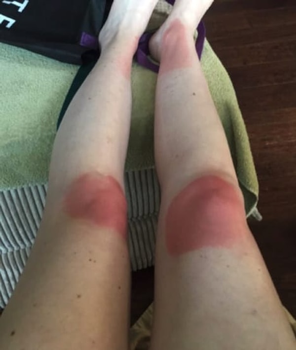 10. И как вы теперь планируете носить короткие шорты или юбки, скажите на милость?!