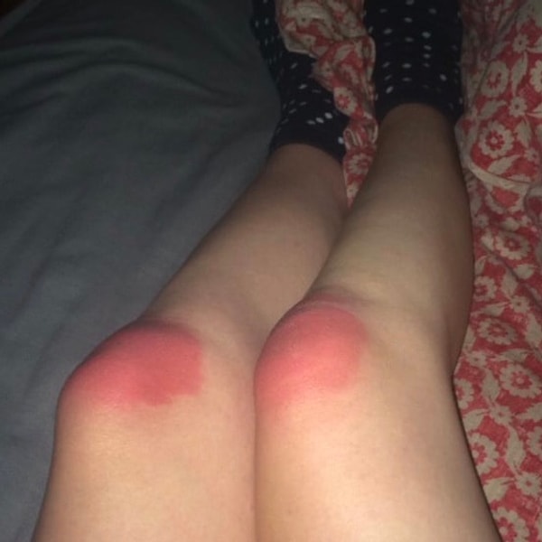 12. Кажется, этим летом стоит подумать об альтернативе рваным джинсам...