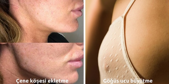 Görünce 'Gerçekten Gerek Var mı?' Dedirten Son Dönemin İlginçlikte Sınır Tanımayan Estetik Operasyonları