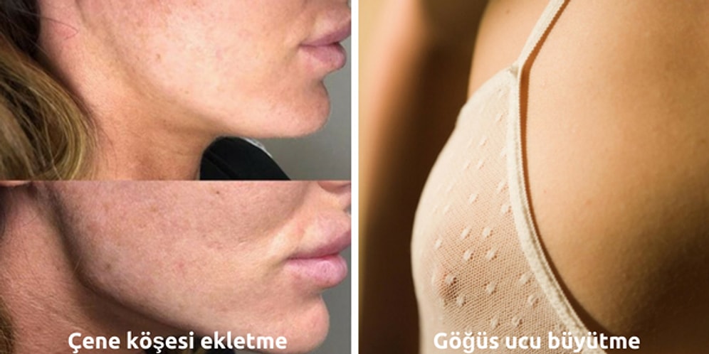 Görünce 'Gerçekten Gerek Var mı?' Dedirten Son Dönemin İlginçlikte Sınır Tanımayan Estetik Operasyonları