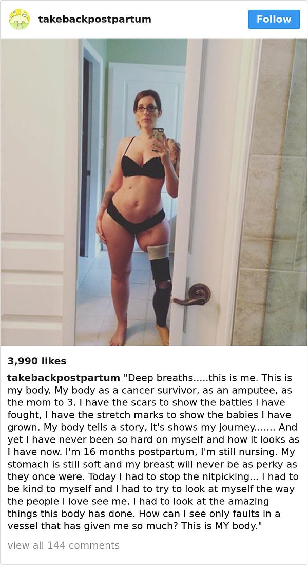 1. Эта женщина перенесла рак, ампутацию ноги и дала жизнь 3-м детям. С последних родов прошло 16 месяцев, и она все еще кормит грудью. Неужели после всего, что она прошла, она должна стыдиться своего тела?