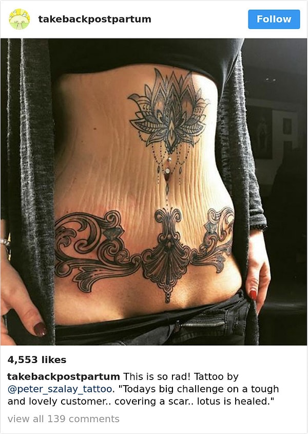 8. Девушка решила сделать татуировку, чтобы скрыть шрам