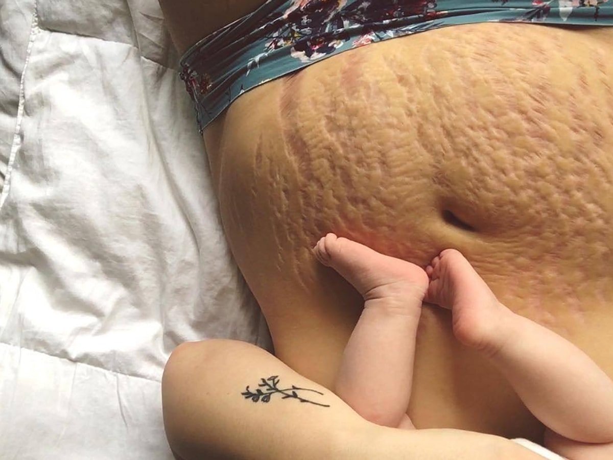 Как падать на спину на батуте. Сильно упал на живот. Лежа на животе. Сильно упал на живот. Растяжкиот ажирения.