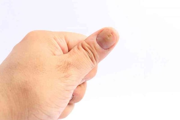 5. Светлые и тёмные линии на ногтях