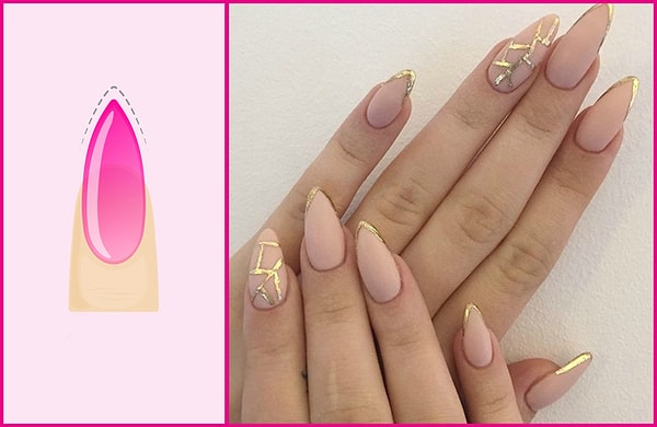 5. Острая форма