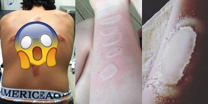 Kitlelere Zarar Veren Mavi Balina Oyunundan Sonraki Yeni Çılgınlık: "Tuz ve Buz Challenge"