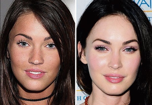 6. Филлеры для бровей