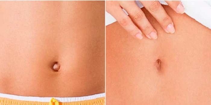 "Нет предела совершенству", или 14 новомодных эстетических операций