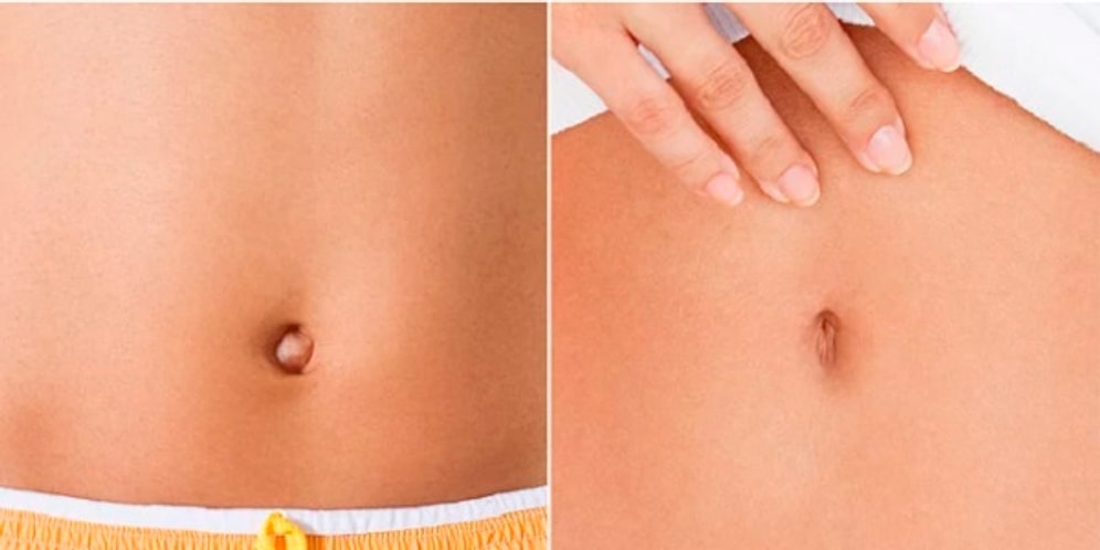 "Нет предела совершенству", или 14 новомодных эстетических операций