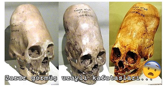 Antik Zamandan Kalan İskeletler İçin Ortaya Atılan Efsanelerle İlgili Gerçekleri Duyunca Çok Şaşıracaksınız!
