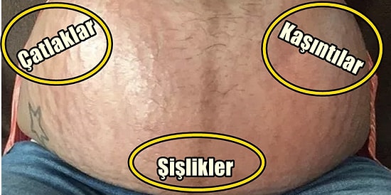 Hamileliğin İyi, Kötü ve Çirkin Yanlarını Harika Bir Şekilde Özetleyen 22 Kare