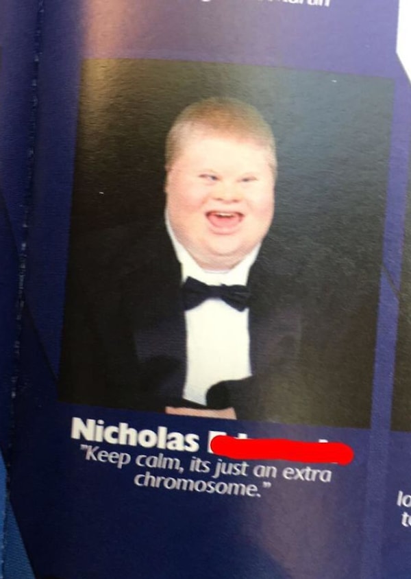 1. "Спокойствие, это всего лишь лишняя хромосома"