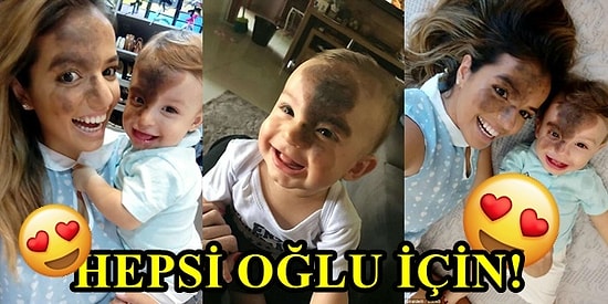 Yüzünde Doğum Lekesiyle Doğan Oğlu Normal Hissetsin Diye Kendi Yüzünü Boyayan Anne