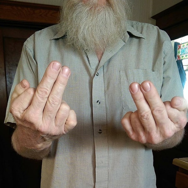 22. Пальцы! Посчитайте его пальцы! 😱