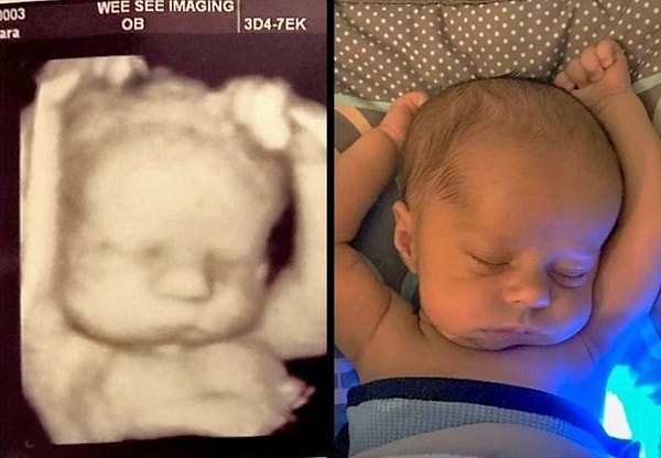 3. За пару недель до родов и через пару недель после