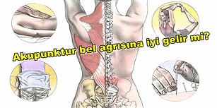 Bel Ağrısı Çekenler Buraya! Ağrılarınız Hakkında Merak Ettiğiniz 25 Soru ve Cevabı