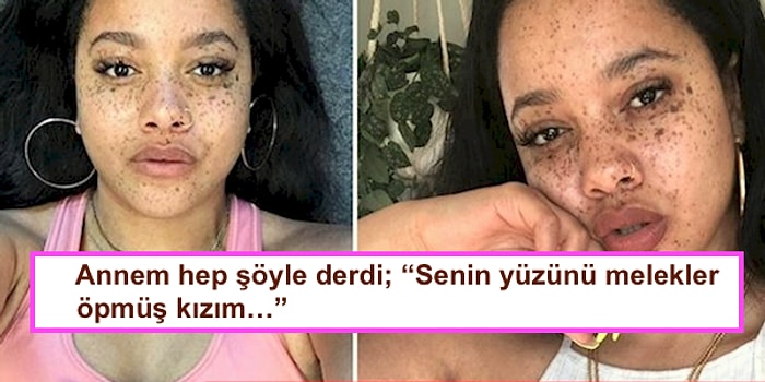 Yıllarca Dalga Geçilen Çilleri ile Meşhur Olup Güzelliğini Göğsünü Gere Gere Taşıyan Kadın